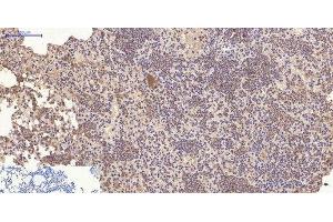 Immunohistochemistry of paraffin-embedded Mouse lung tissue using CD10 Monoclonal Antibody at dilution of 1:200.