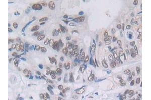 Immunohistochemistry (IHC) image for anti-phospholipase C, gamma 1 (PLCG1) (AA 1091-1290) antibody (ABIN7431485)