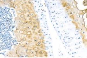 Immunohistochemistry analysis of paraffin-embedded mouse bone using,Bone Sialoprotein (ABIN7073219) at dilution of 1: 750