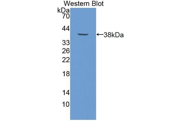 HDC antibody  (AA 341-597)