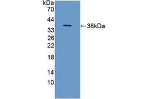 Detection of Recombinant ITIH1, Human using Polyclonal Antibody to Inter Alpha-Globulin Inhibitor H1 (ITIH1) (ITIH1 Antikörper  (AA 507-819))