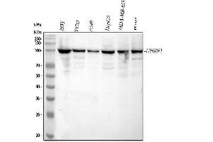 Western blot analysis of UHRF1 using anti-UHRF1 antibody (ABIN3044567).