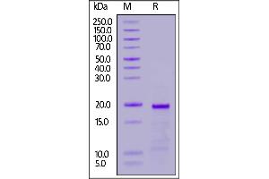 Human TOP2A, Tag Free on  under reducing (R) condition. (Topoisomerase II alpha Protein (AA 1354-1473))