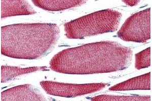 Anti-GPR43 antibody  ABIN1048823 IHC staining of human skeletal muscle.