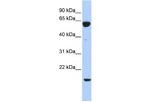 PTP4A3 antibody used at 1 ug/ml to detect target protein. (PTP4A3 Antikörper  (Middle Region))