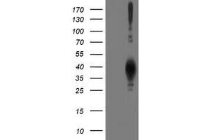 Western Blotting (WB) image for anti-Leucine Carboxyl Methyltransferase 1 (LCMT1) antibody (ABIN1499107)