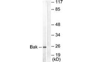 Western blot analysis of extracts from 293 cells, using Bak Antibody. (BAK1 Antikörper  (AA 1-50))