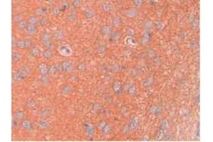 IHC-P analysis of Rat Brain Tissue, with DAB staining. (SPTAN1 Antikörper  (AA 2071-2269))
