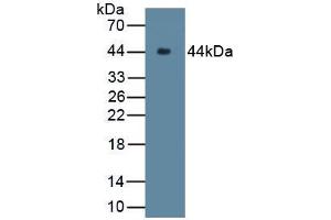 Western blot analysis of recombinant Rabbit C9. (C9 Antikörper  (AA 139-519))