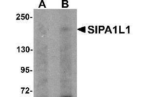 Western Blotting (WB) image for anti-Signal-Induced Proliferation-Associated 1 Like 1 (SIPA1L1) (N-Term) antibody (ABIN1031564)
