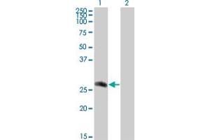 Western Blot analysis of CDC42EP2 expression in transfected 293T cell line by CDC42EP2 monoclonal antibody (M01), clone 2H7. (CDC42EP2 Antikörper  (AA 102-210))