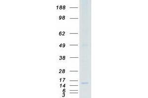 Western Blotting (WB) image for Prostaglandin E Synthase (PTGES) protein (Myc-DYKDDDDK Tag) (ABIN2730064)