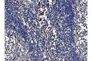 IHC analysis of Bim/BCL2L11 using anti-Bim/BCL2L11 antibody (ABIN7602855).
