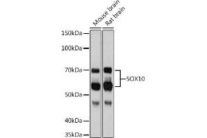 Western blot analysis of extracts of various cell lines, using SOX10 Rabbit mAb (ABIN7270567) at 1:1000 dilution.