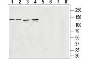 Western blot analysis of rat brain membranes (lanes 1 and 5), mouse brain membranes (lanes 2 and 6), human U-87 MG glyoblastoma lysates (lanes 3 and 7) and human SH-SY5Y brain neuroblastoma lysates (lanes 4 and 8): - 1-4. (SLC32A1 Antikörper  (Cytosolic, N-Term))