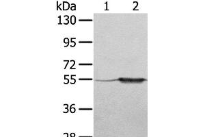 Western Blot analysis of A375 cell and Human fetal muscle tissue using TRIM35 Polyclonal Antibody at dilution of 1:550 (TRIM35 Antikörper)