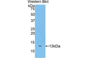 Western Blotting (WB) image for anti-ADAM Metallopeptidase with Thrombospondin Type 1 Motif, 7 (ADAMTS7) (AA 1589-1686) antibody (ABIN1077727)