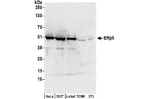 Western Blotting (WB) image for anti-Protein Disulfide Isomerase Family A, Member 6 (PDIA6) (AA 390-440) antibody (ABIN7453917)