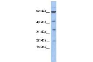 Image no. 1 for anti-LIM Domain Only 2 (Rhombotin-Like 1) (LMO2) (AA 35-84) antibody (ABIN6744411) (LMO2 Antikörper  (AA 35-84))