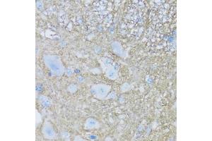 Immunohistochemistry of paraffin-embedded mouse spinal cord using B2 antibody (ABIN7265773) at dilution of 1:100 (40x lens). (ATP1B2 Antikörper  (AA 68-290))