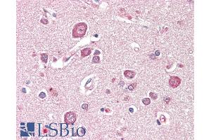 ABIN1019666 (5µg/ml) staining of paraffin embedded Human Cortex. (SDCCAG8 Antikörper  (Internal Region))