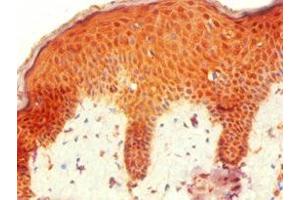 Immunohistochemistry of paraffin-embedded human skin tissue using ABIN7155744 at dilution of 1:100