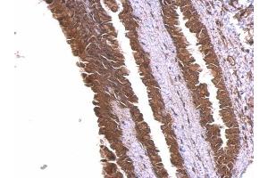 IHC-P Image alpha Adducin antibody detects alpha Adducin protein at membrane and cytosol on mouse esophagus by immunohistochemical analysis.