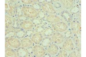 Immunohistochemistry of paraffin-embedded human kidney tissue using ABIN7145332 at dilution of 1:100 (BNIP3L/NIX Antikörper  (AA 1-187))