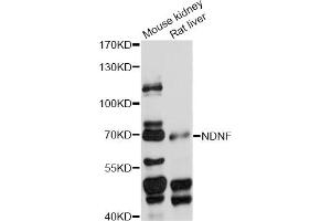 Western blot analysis of extracts of various cell lines, using NDNF antibody (ABIN6294153) at 1:1000 dilution.