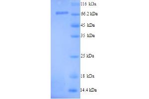 SDS-PAGE (SDS) image for Peptidyl Arginine Deiminase, Type I (PADI1) (AA 1-663), (full length) protein (His tag) (ABIN5714510)