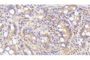 Detection of BMP2 in Human Small intestine Tissue using Polyclonal Antibody to Bone Morphogenetic Protein 2 (BMP2) (BMP2 Antikörper  (AA 24-396))