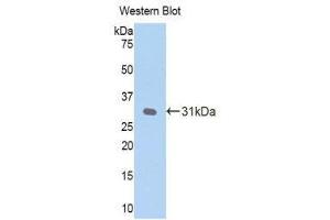 Western Blotting (WB) image for anti-C-Reactive Protein (CRP) (AA 20-225) antibody (ABIN1077877) (CRP Antikörper  (AA 20-225))