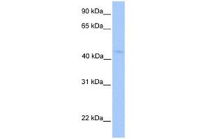 WB Suggested Anti-LIPT1 Antibody Titration:  0.