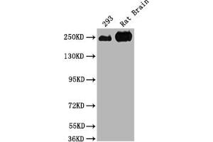 Western Blot Positive WB detected in: 293 whole cell lysate, Rat Brain tissue All lanes: MYH10 antibody at 1:2000 Secondary Goat polyclonal to rabbit IgG at 1/50000 dilution Predicted band size: 229, 231, 232, 233 kDa Observed band size: 250 kDa (MYH1 Antikörper  (AA 1439-1544))