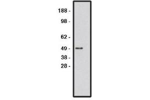 Image no. 1 for anti-Roundabout, Axon Guidance Receptor, Homolog 1 (ROBO1) antibody (ABIN265227) (ROBO1 Antikörper)