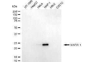Western blotting analysis using MAD2L1 antibody (ABIN7799317).