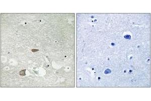 Immunohistochemistry (IHC) image for anti-Cadherin EGF LAG Seven Pass G-Type Receptor 2 (CELSR2) (AA 2781-2830) antibody (ABIN1534327)