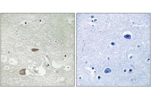 Immunohistochemistry analysis of paraffin-embedded human brain tissue, using CELSR2 Antibody.