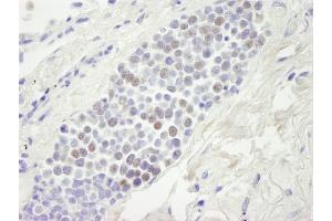 Immunohistochemistry (IHC) image for anti-Minichromosome Maintenance Deficient 4 (MCM4) (AA 325-375) antibody (ABIN7448653)