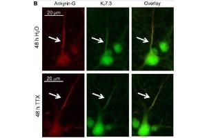 Cultured rat hippocampal neurons (DIV 11-12) were treated for 48 h with 1 μM TTX or its vehicle control (0. (Ankyrin G Antikörper)