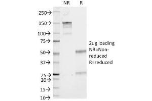 SDS-PAGE Analysis Purified CD53 Mouse Monoclonal Antibody (161-2). (CD53 Antikörper)