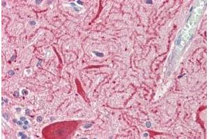 Immunohistochemistry (IHC) image for anti-Solute Carrier Family 2 (Facilitated Glucose Transporter), Member 13 (SLC2A13) (AA 268-297) antibody (ABIN1804829)