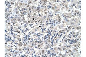 Immunohistochemistry (IHC) image for anti-Cerebellar Degeneration-Related Protein 2, 62kDa (CDR2) (N-Term) antibody (ABIN311402) (CDR2 Antikörper  (N-Term))
