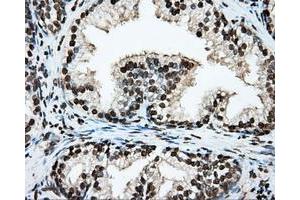 Immunohistochemical staining of paraffin-embedded lung tissue using anti-ARNTL mouse monoclonal antibody. (ARNTL Antikörper)