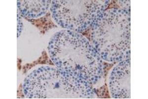 IHC-P analysis of Mouse Testis Tissue, with DAB staining. (PZP Antikörper  (AA 1224-1495))