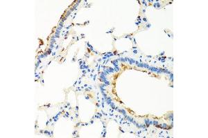 Immunohistochemistry of paraffin-embedded rat lung using RGS5 antibody (ABIN5975077) at dilution of 1/100 (40x lens). (RGS5 Antikörper)