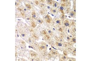 Immunohistochemistry of paraffin-embedded human liver injury using DARS antibody at dilution of 1:100 (x40 lens).