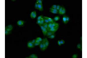 Immunofluorescence staining of HepG2 cells with ABIN7155981 at 1:100, counter-stained with DAPI. (HAO1 Antikörper  (AA 161-273))