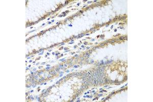 Immunohistochemistry of paraffin-embedded human stomach using PDIA3 antibody (ABIN5970443) at dilution of 1/100 (40x lens). (PDIA3 Antikörper)