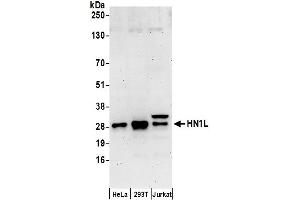anti-Hematological and Neurological Expressed 1-Like (HN1L) (AA 140-190) antibody
